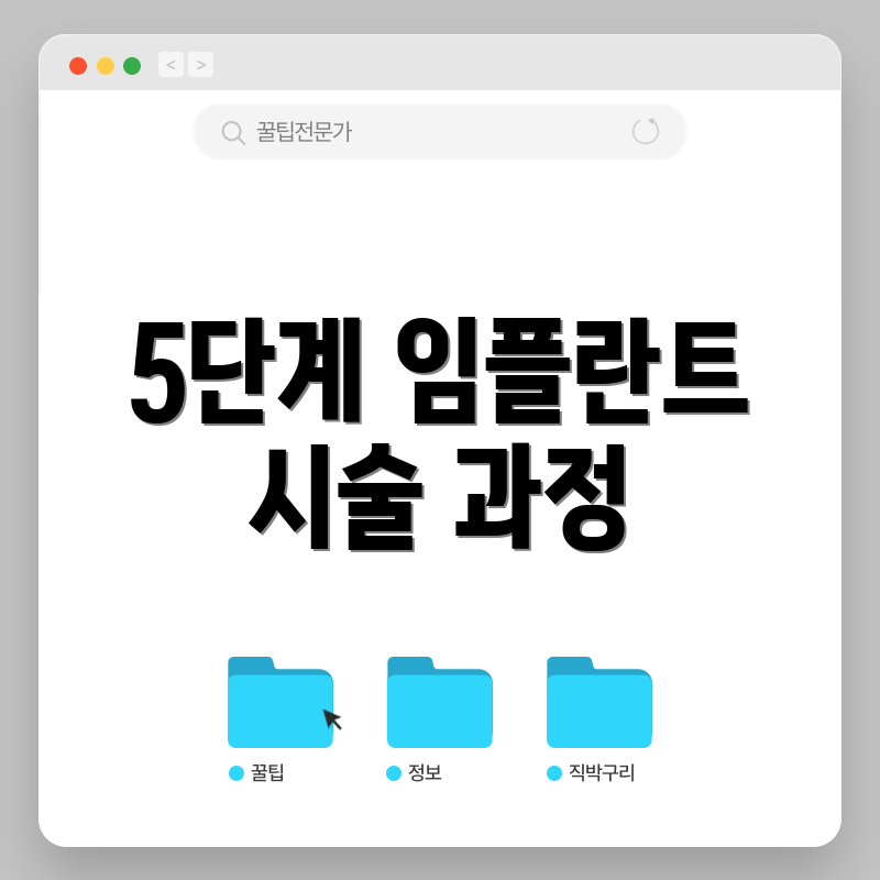 5단계 임플란트 시술 과정